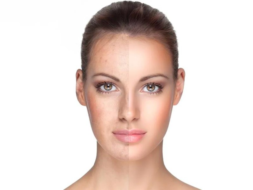Can Glutathione IV Drip Help Detoxify Your Skin in Dubai?