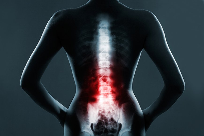Understanding The Difference Between Minimal Invasive Spine Surgery And Traditional Surgery