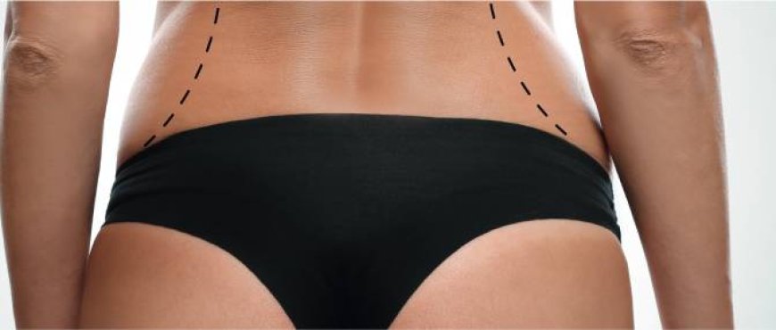 Shape Your Dream Figure with Body Contouring in Dubai