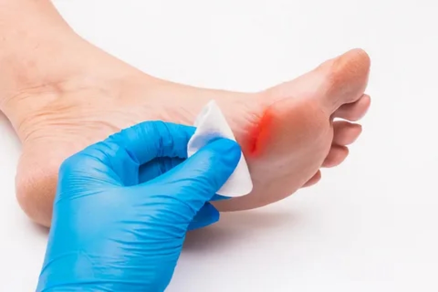 Podiatry Advice for Diabetic Foot Self-Care in Edinburgh