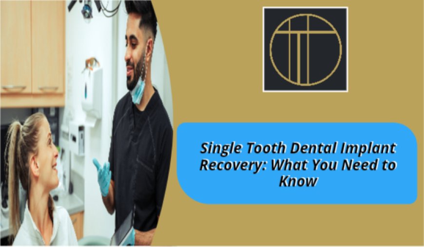Single Tooth Dental Implant Recovery: What You Need to Know
