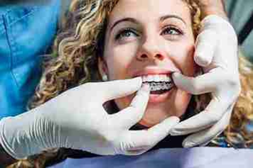 Smile Transformation Starts with Invisible Perfection