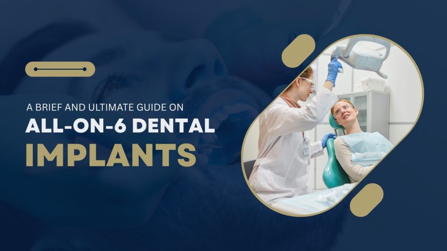 A Brief and Ultimate Guide on All-on-6 Dental Implants