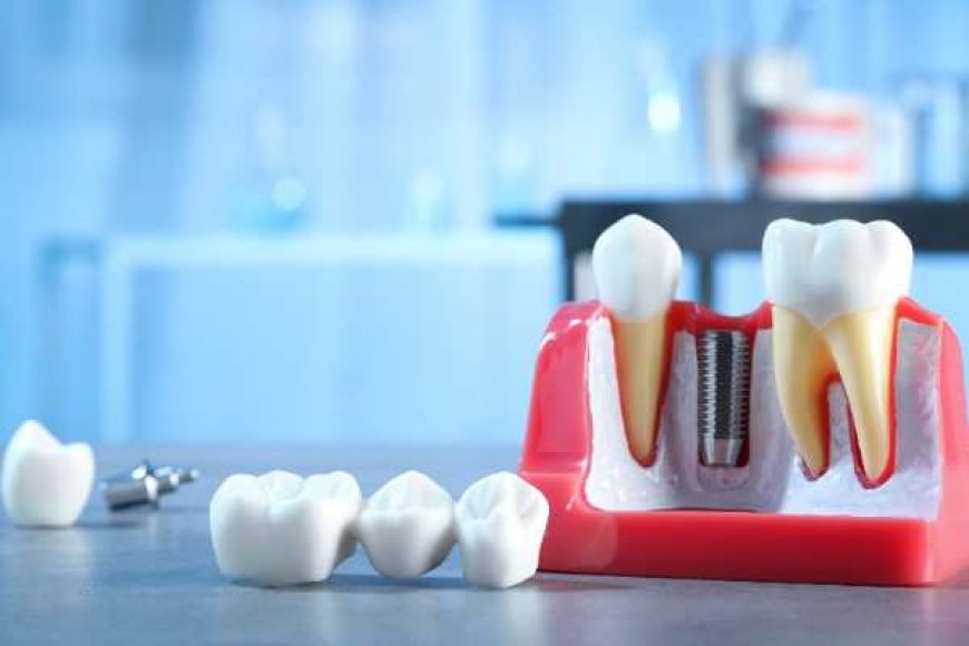 The Foods That Could Delay Your Dental Implant Recovery