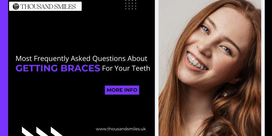 Some of the most frequently asked questions about getting braces for your teeth