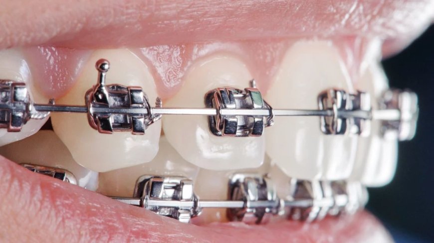 Confident Smiles Start Here Adult Orthodontics in Nampa Idaho
