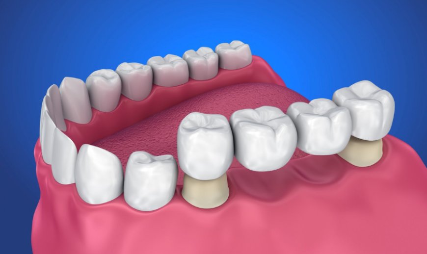 Smile Brighter with Family Cosmetic Dentistry in Caldwell Idaho