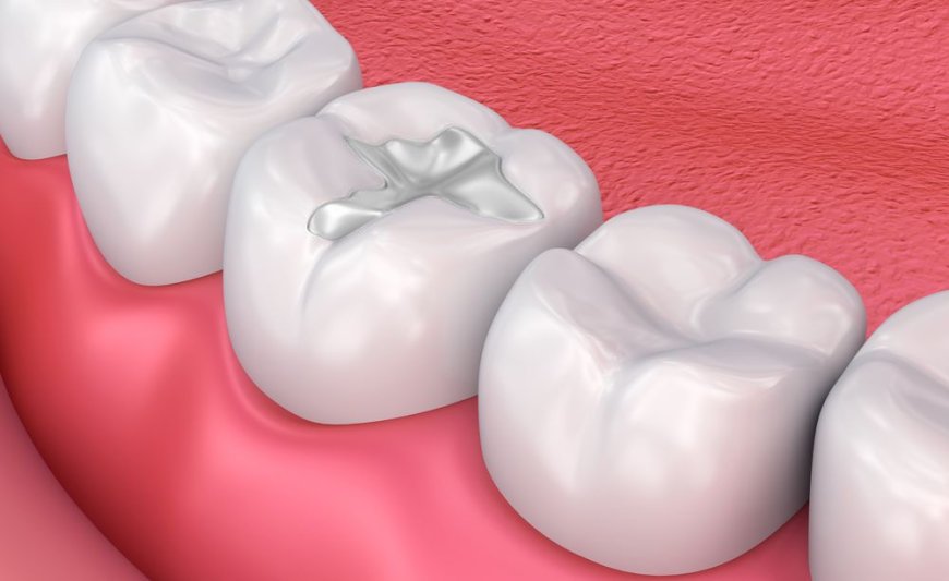 Restore Your Smile with Composite Fillings in Billings MT
