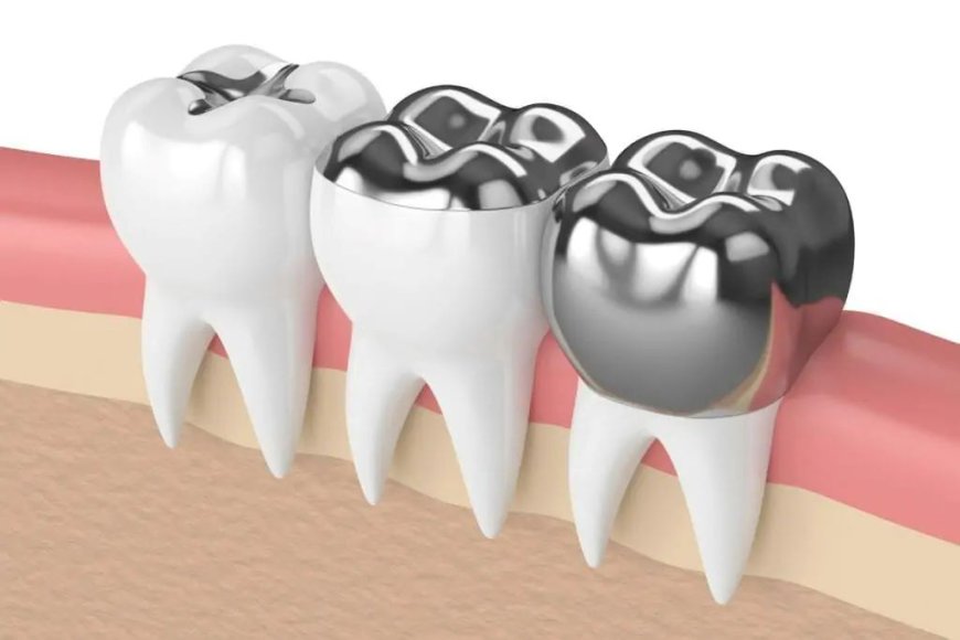 Fix Your Smile Fast with Composite Fillings in Billings MT