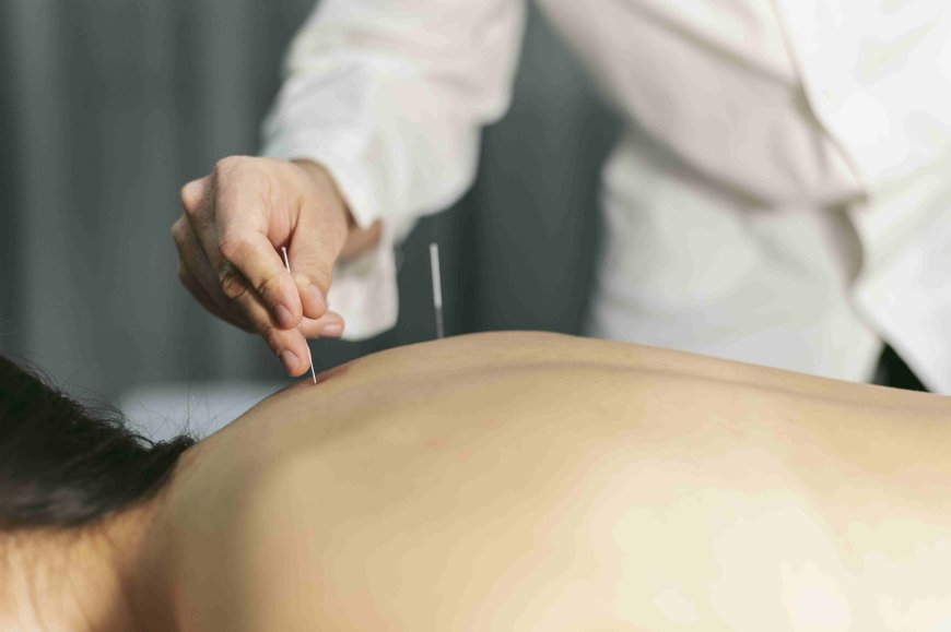How Acupuncture Prepares Your Body for a Successful IVF Journey
