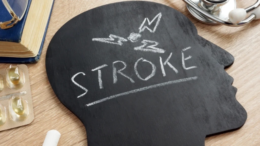 How to Manage Stroke Recovery Effectively