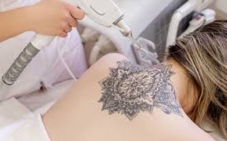 Top Clinics for Laser Tattoo Removal in Essex: A Comprehensive Guide
