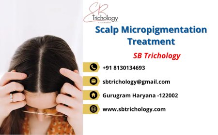 Scalp Micropigmentation Treatment: A Modern Solution for Hair Loss