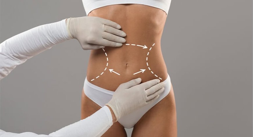 Achieve Flat Abs with Tummy Tuck in Dubai