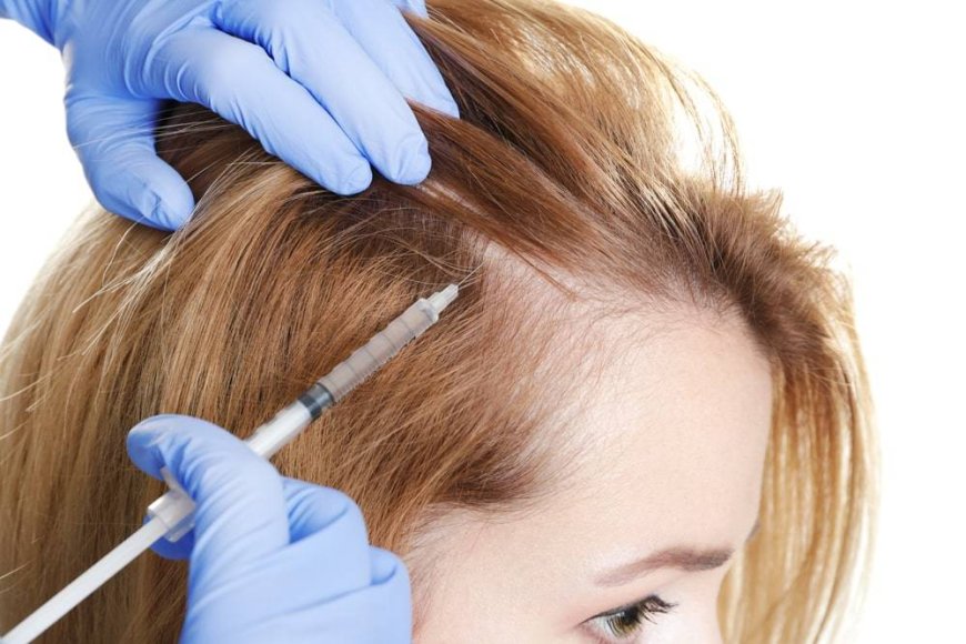 Restore Hair with Best PRP Treatment in Dubai