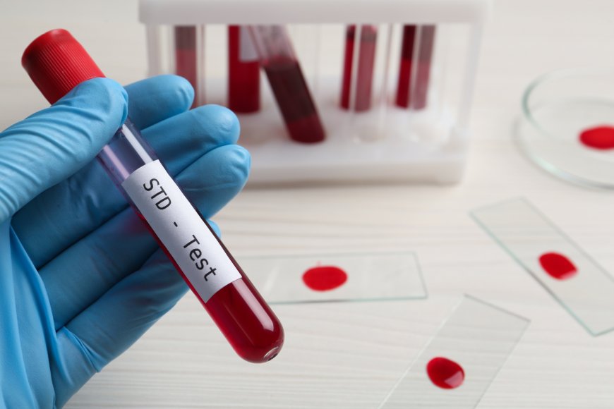 Quick & Easy STD Testing Services in Dubai