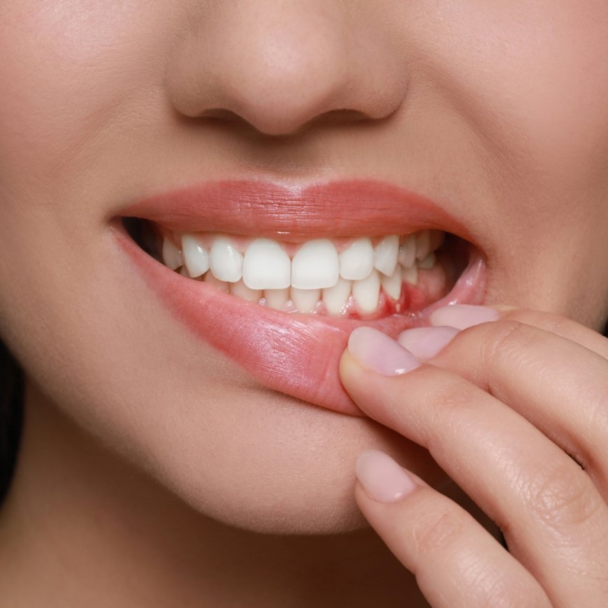 Impact of Smoking on Gum Health: Why Holes in Gums May Develop