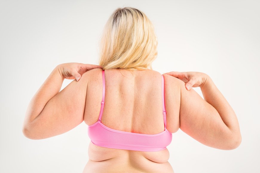 Does Obesity and Bariatric Surgery Reduce Inflammation Markers?