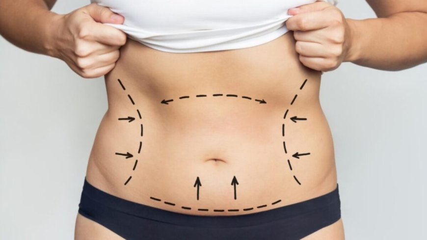 Facts vs Myths Insights from Best Liposuction Surgeon in Dubai