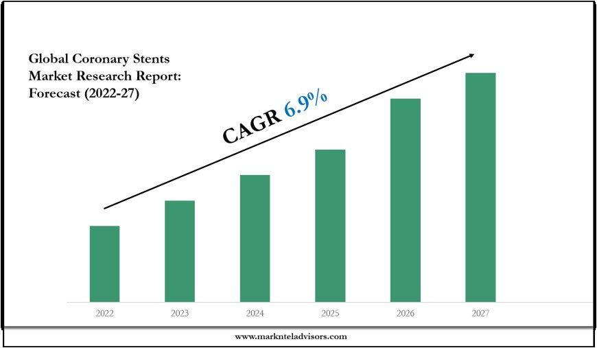 Coronary Stents Market Growth, Trends, and Future Opportunities 2027